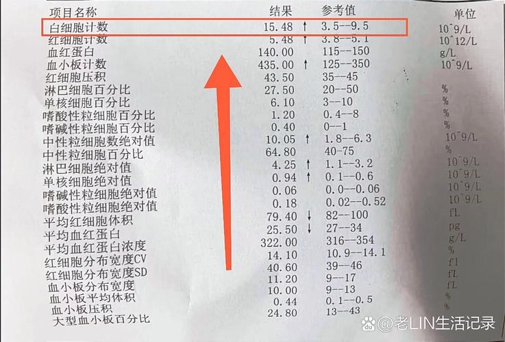 风湿会引起白细胞高吗