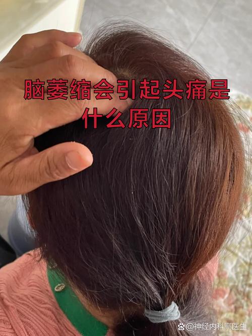 后脑勺胀痛头晕 脑梗