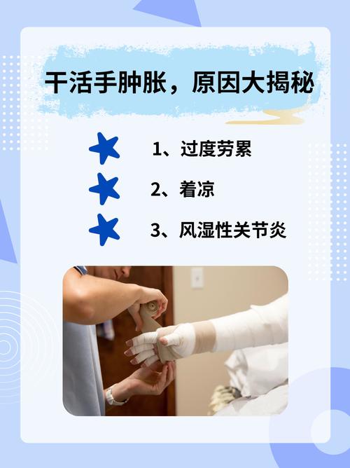 脑梗患者怎样消除手肿