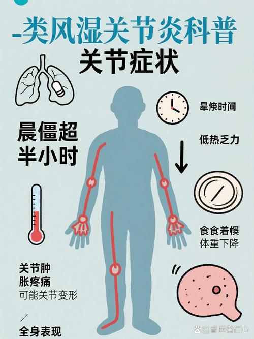 风湿性疾病的疼痛特点