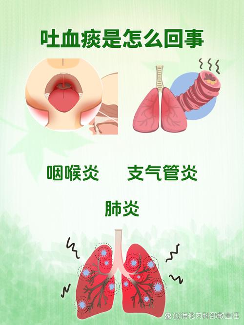 脑梗吐痰出血怎么回事