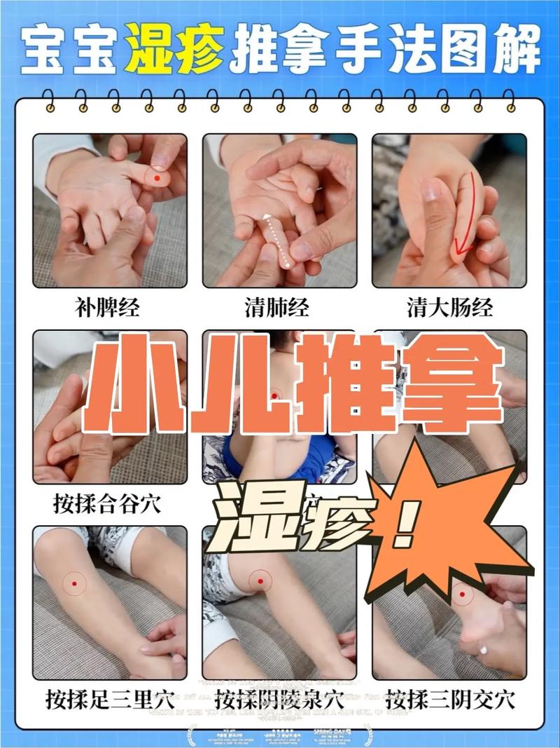 起湿疹按摩什么穴位