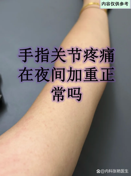 贵阳治风湿麻木在那里