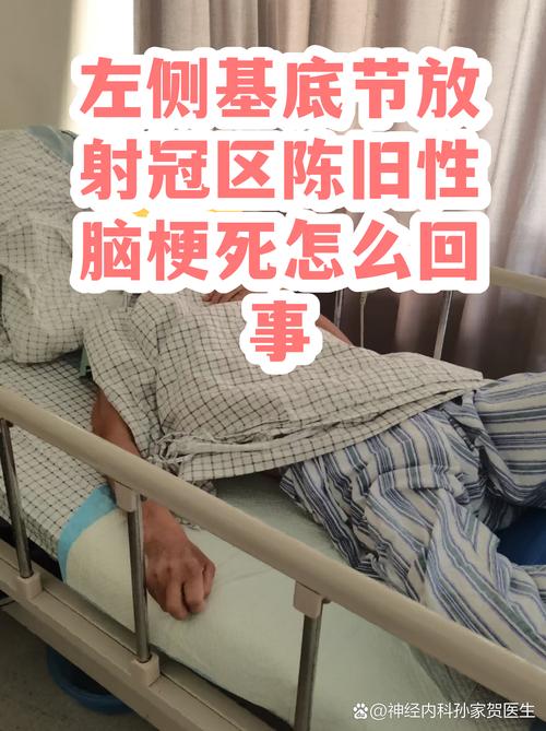 陈旧脑梗的症状有哪些