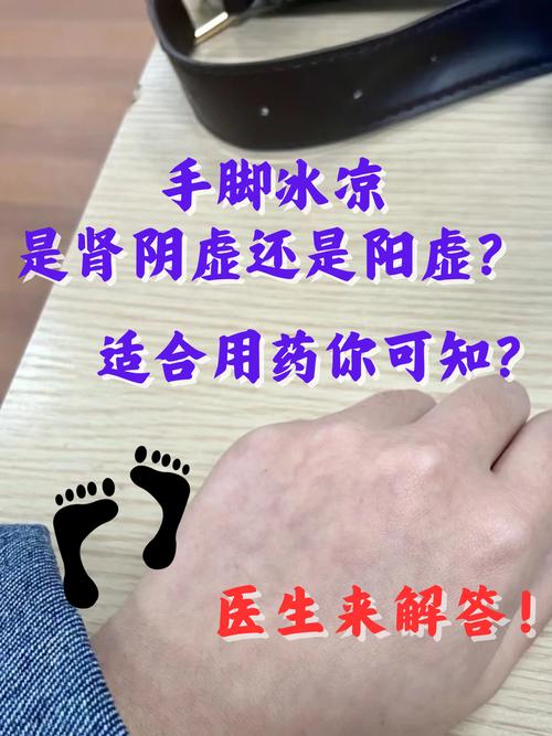 类风湿出汗是肾阳虚吗