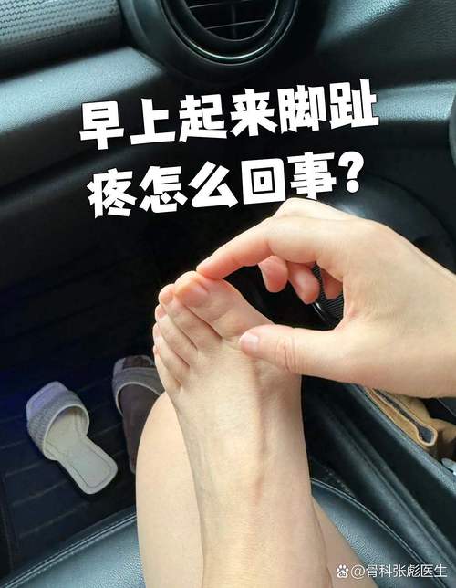 风湿会脚会麻麻的感觉