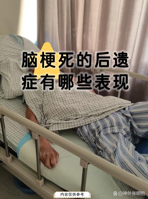 脑梗后什么症状是什么