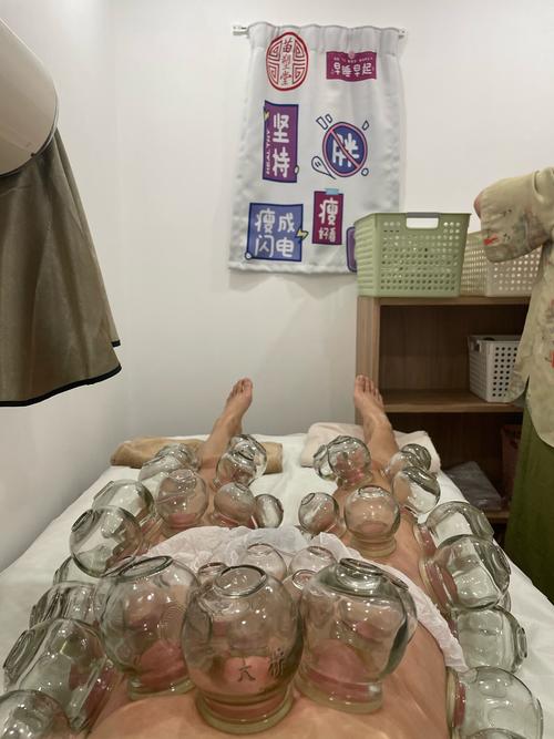 拔罐可以治膝盖风湿吗