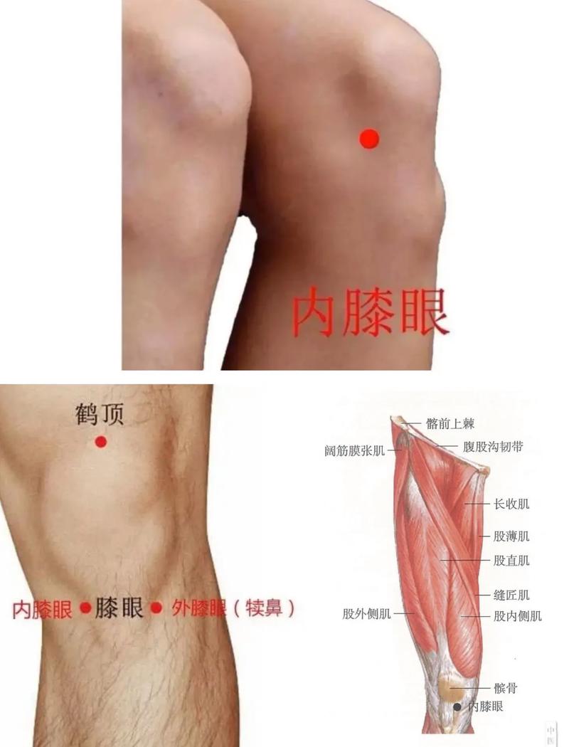 膝盖疼艾灸疗法穴位