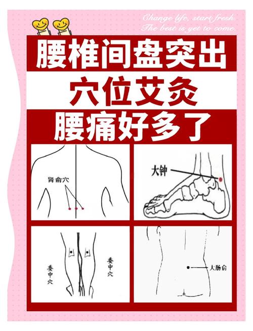 女性腰疼艾灸穴位图