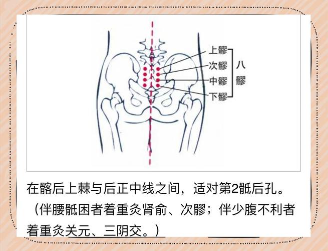 女性腰疼艾灸穴位图