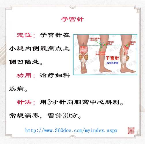 孕妇针灸禁忌穴位图