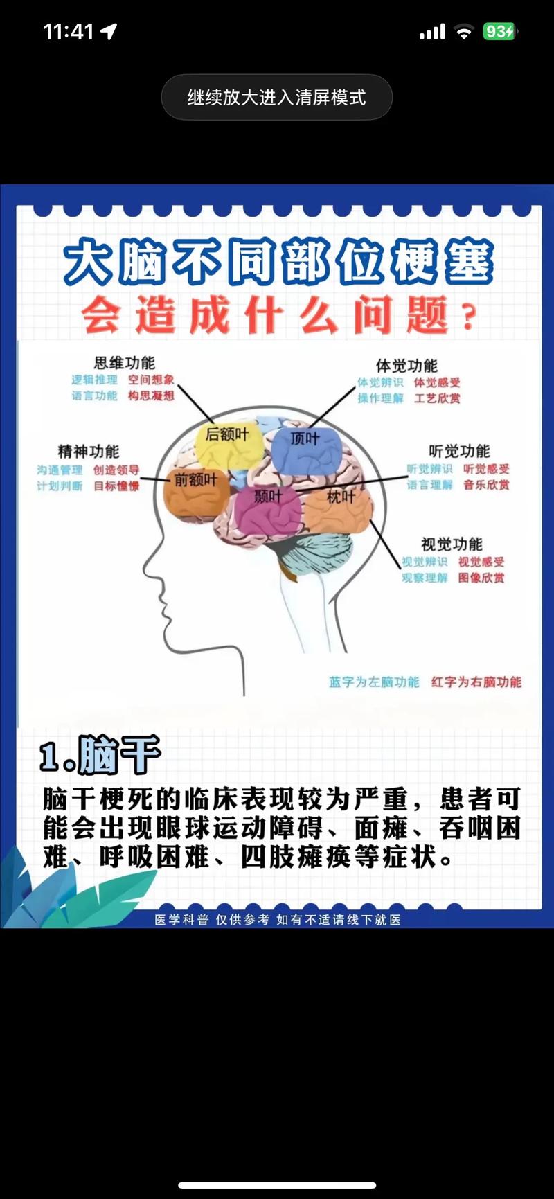 脑梗生活中要注意什么