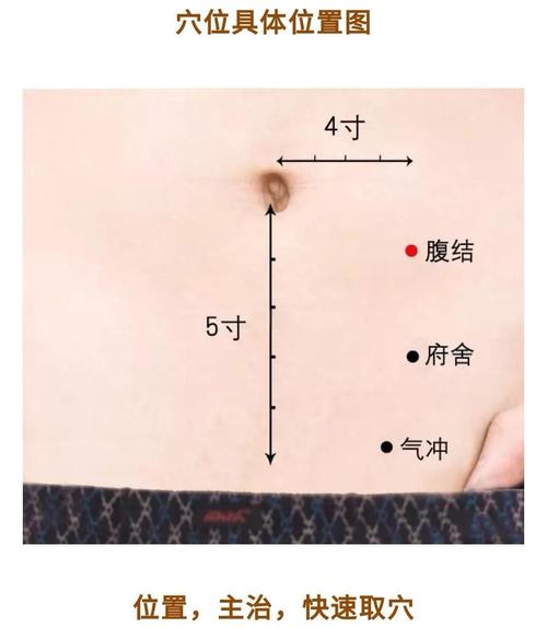 减肚子针灸什么穴位