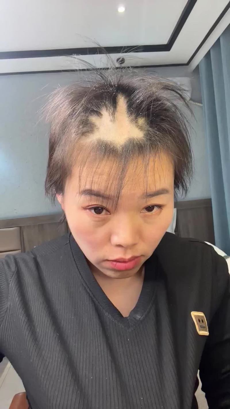 脑梗的人可以焗头发吗