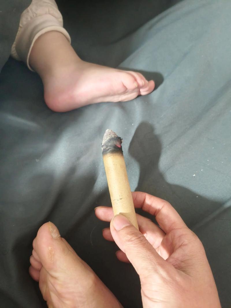 宝宝喉炎灸什么穴位