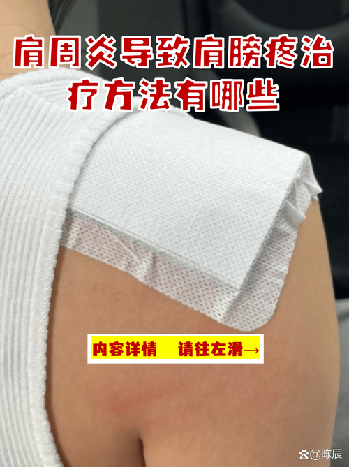 胳膊风湿疼怎么贴膏药