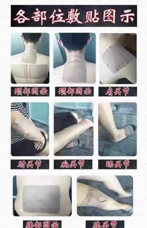 胳膊风湿疼怎么贴膏药