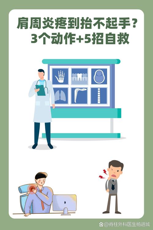 风湿性肩周炎如何解决