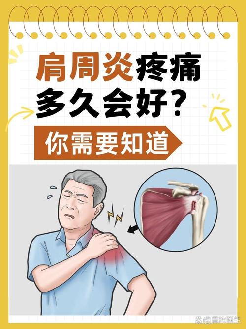 肩膀疼可以挂风湿科吗