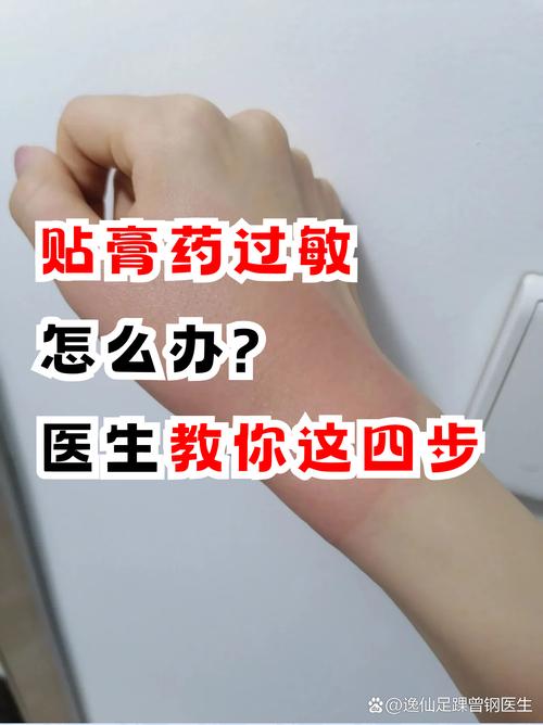 为什么贴风湿膏冒凉风