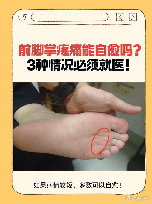 肾虚脚风湿肿痛怎么办