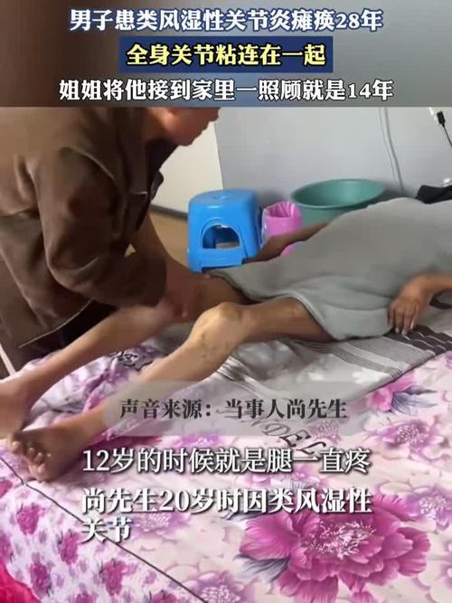 风湿病为什么全身瘫痪