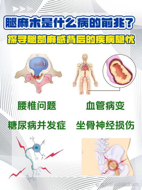 风湿病为什么全身瘫痪