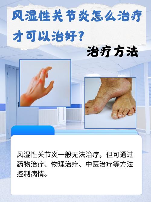风湿关节炎治疗的疗法