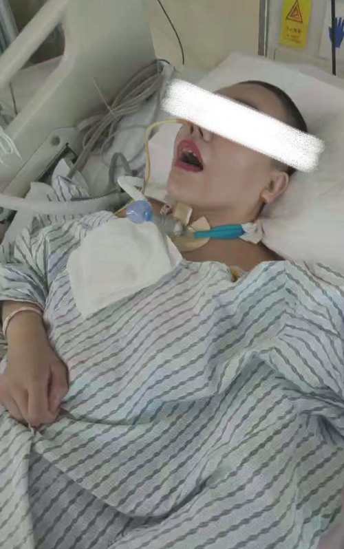 脑梗昏迷病人呼吸急促