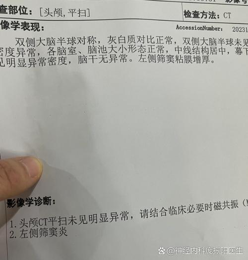 总是头疼 检查是脑梗