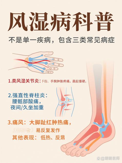 确定风湿热的主要表现