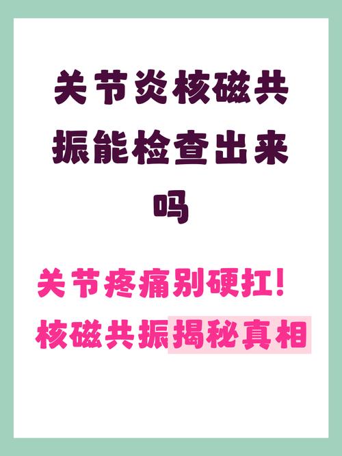核磁共振可以查风湿吗