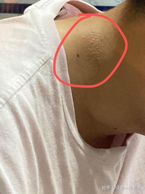 房间挂湿衣服会风湿吗