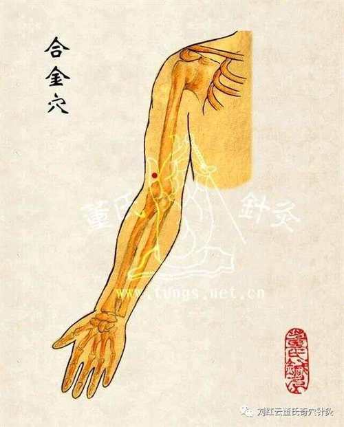 手臂酸痛针灸穴位图