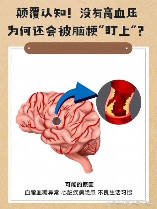 脑梗与血糖高有关系吗