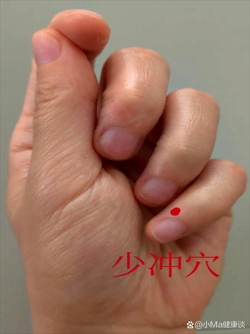 针灸哪个穴位降心火