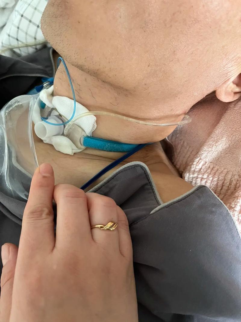 脑梗病人气管切开打嗝