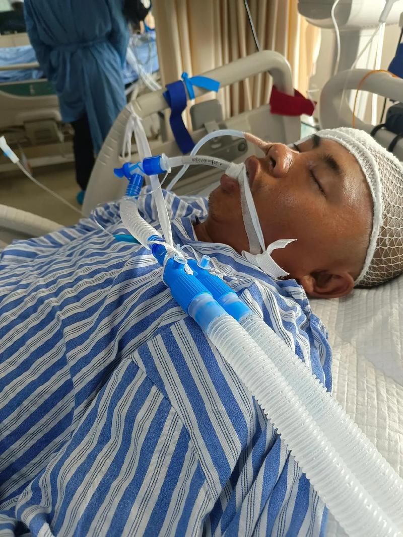 脑梗病人鼻饲管并发症