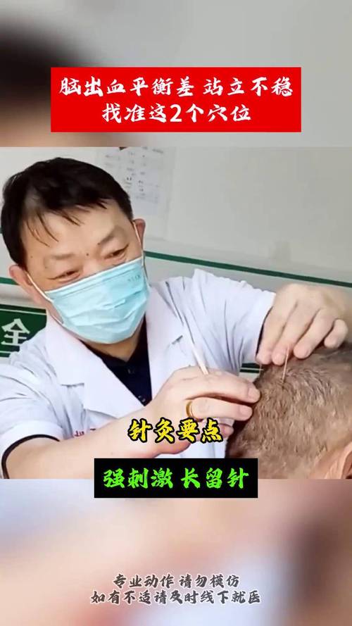 脑出血针灸治疗穴位
