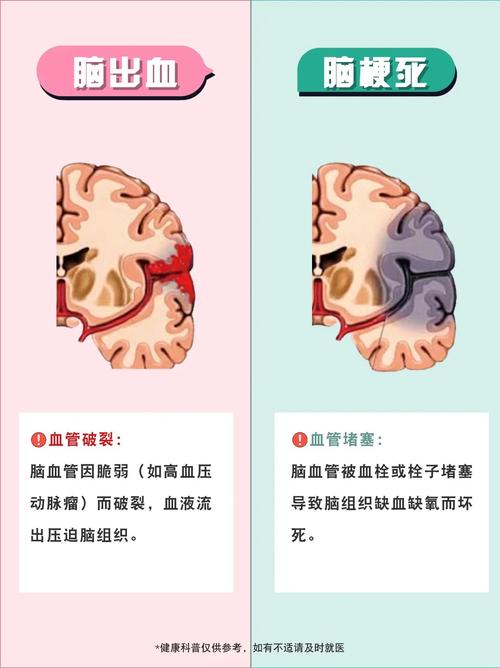 脑出血又有脑梗怎么办