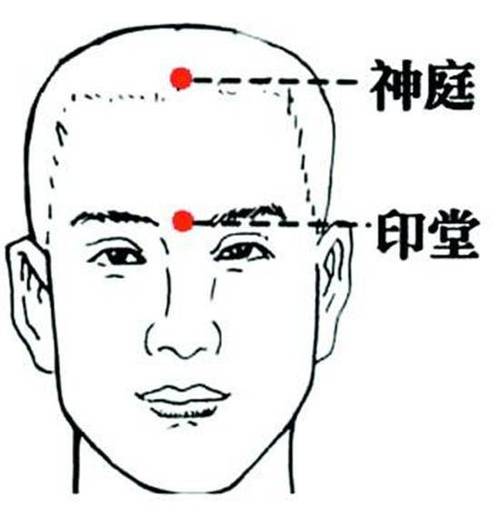 脑出血偏瘫打通穴位