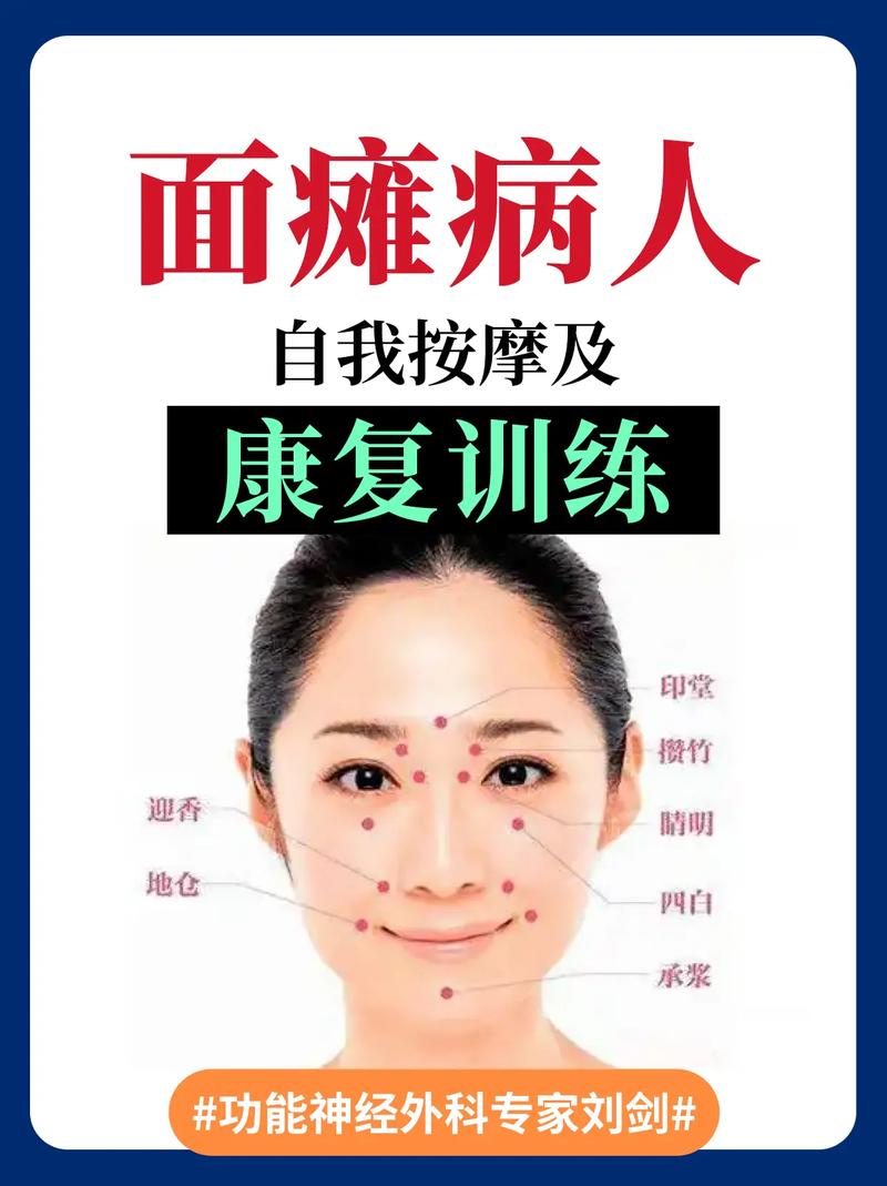 按哪个穴位治疗面瘫