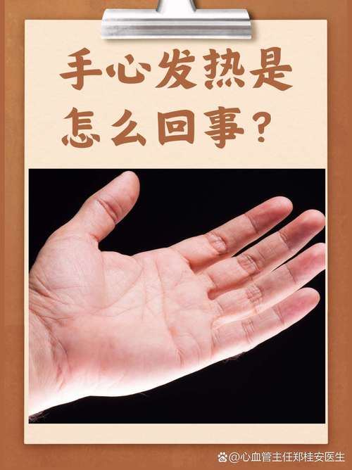 类风湿手掌发热怎么办