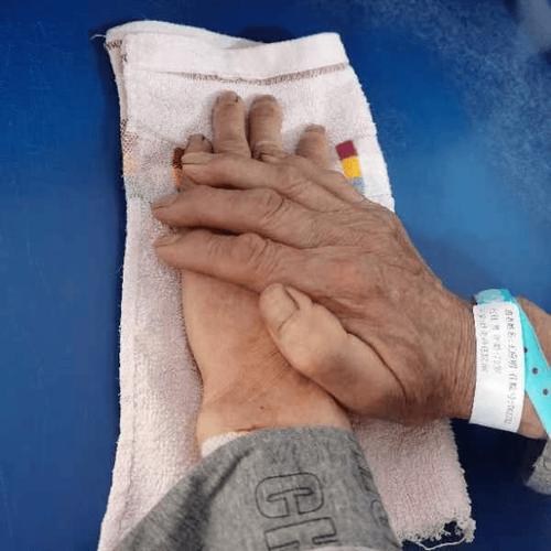 脑梗病人胳膊康复训练