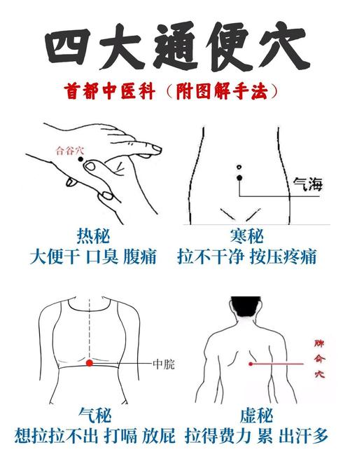 便秘有哪些推拿穴位