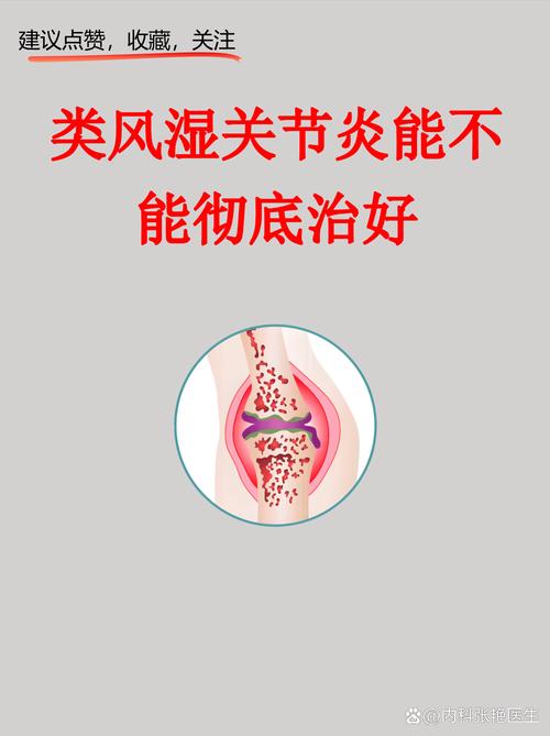 那家医院治风湿关节炎