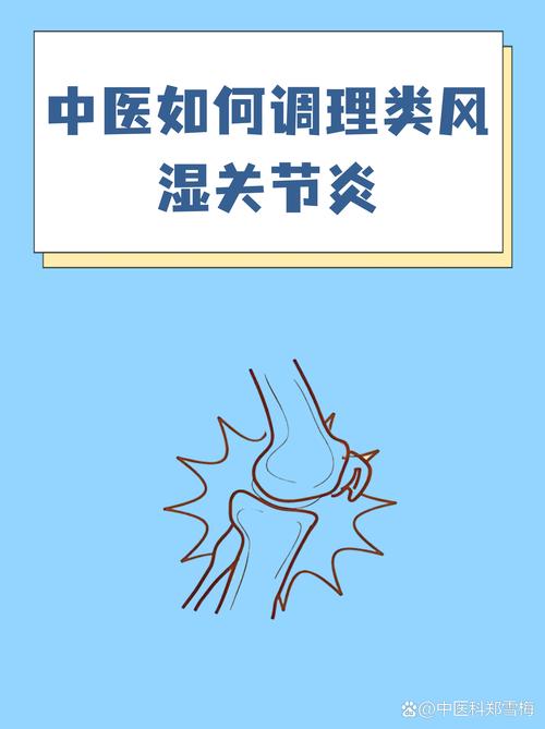 那家医院治风湿关节炎