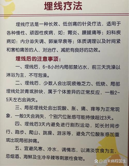 针灸 穴位埋线疗法