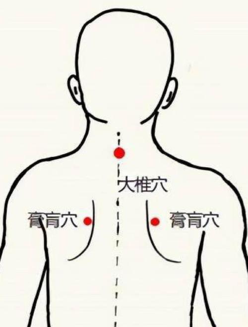 老人退烧灸哪个穴位